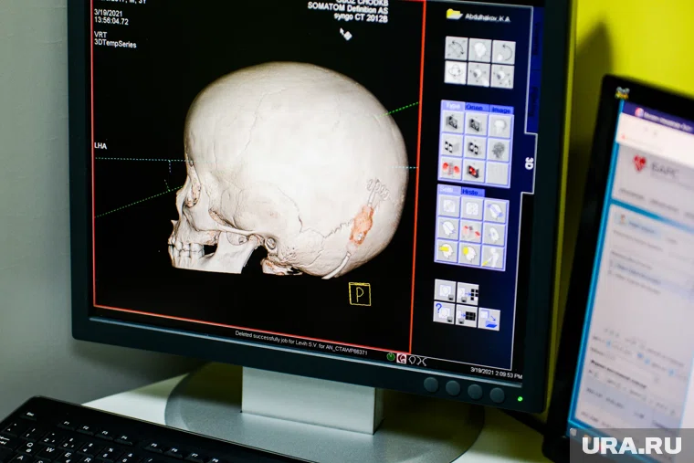 КТ починили в Шумихе