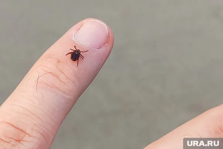 Все шесть погибших от энцефалита южноуральцев не были привиты