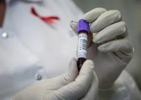 В Канаде выдвинули новую версию о нулевом ВИЧ-пациенте