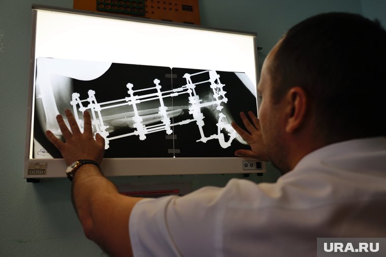 В Кургане провели операцию женщине, которая упала с высоты восьмого этажа. Фото