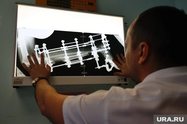 Юношу из Кировской области лечили в Центре Илизарова (архивное фото)