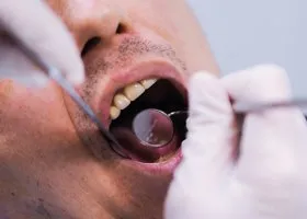 Власти РФ раскрыли, как будут спасать зубы россиян