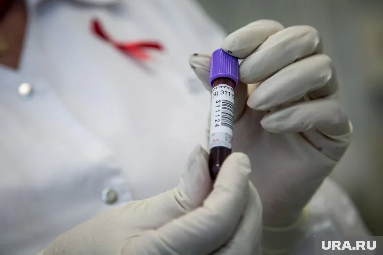 Пермский край оказался в тройке лидеров по числу ВИЧ-инфицированных