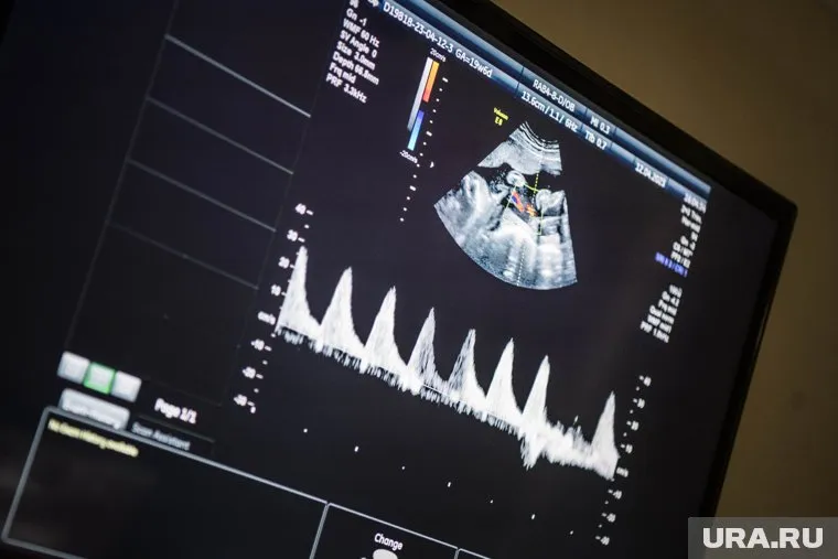 Власти Орловской области расширили программу финансовой поддержки беременных, включив в нее школьниц