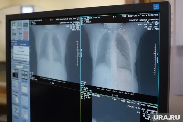 На проблемы с психикой после коронавируса жалуются даже легко переболевшие люди