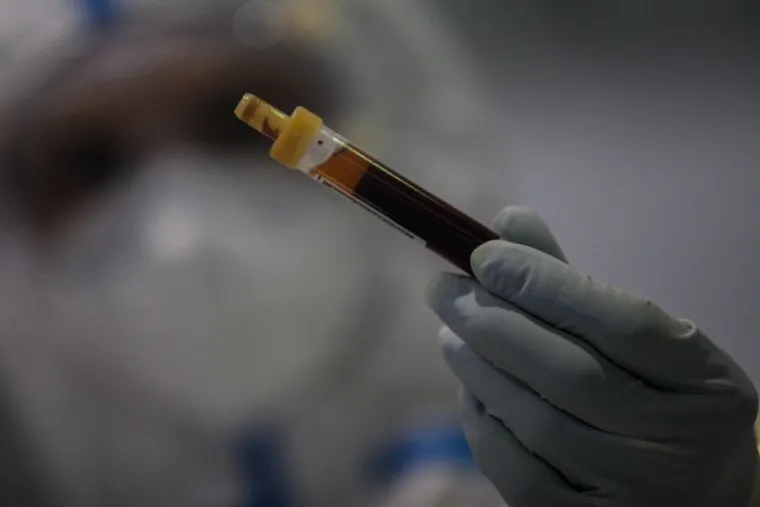 Красная зона, ковид госпиталь на ВДНХ. Москва