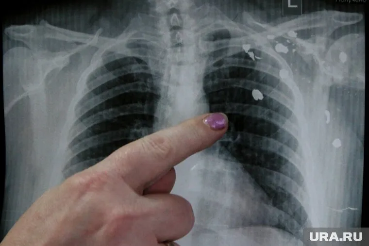 Компоненты жидкостей для курения могут вызвать болезни дыхательной системы, считает Маринэ Гамбарян.