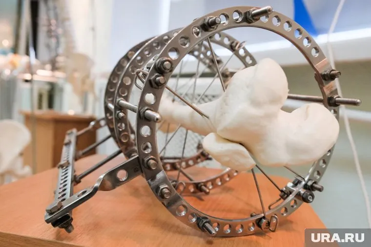 В итальянском городе Лекко поставили памятник в виде гигантского аппарата Илизарова