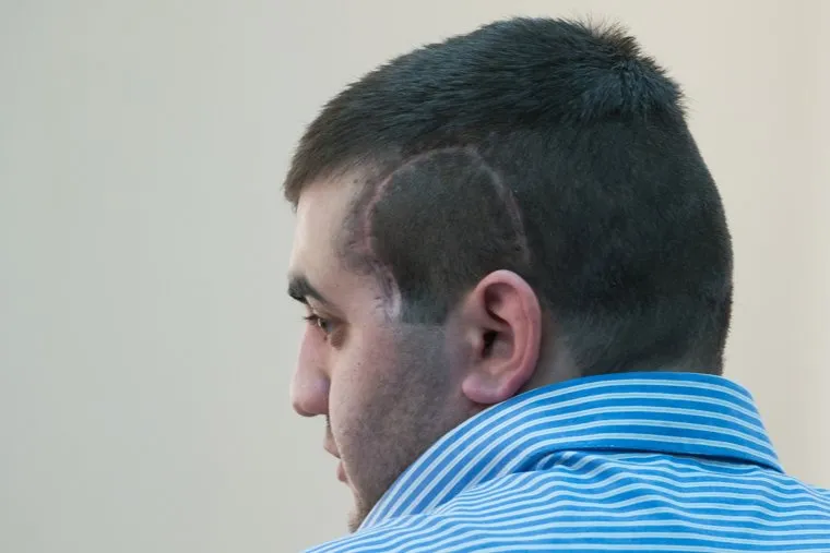 Процесс по делу Владислава Рябухина. Екатеринбург, арутюнян саргис, шрам