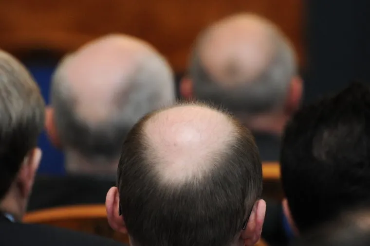 Лысины. Челябинск.