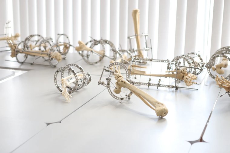 Курганские ученые обучили нейросеть создавать имплантаты, которые помогут при тяжелых травмах. Фото