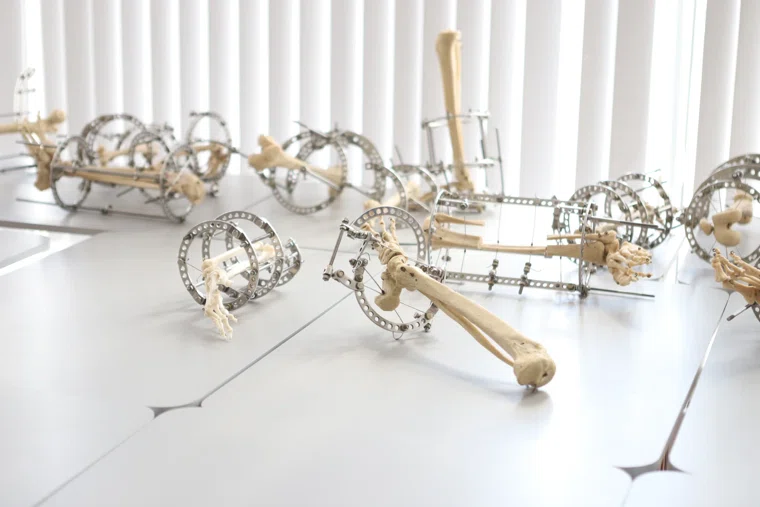 В Кургане разрабатывают костные импланты с помощью ИИ (архивное фото)