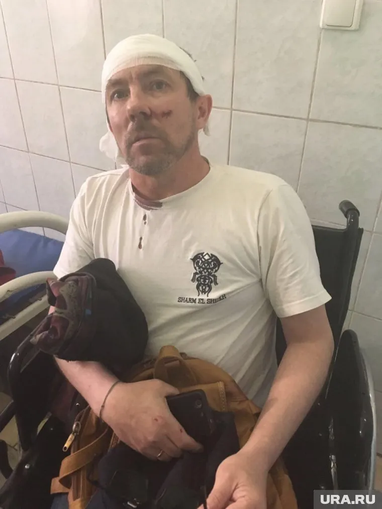 Уральского активиста покалечил охранник с лопатой