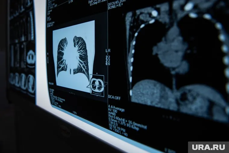 Чувствительность КТ к COVID-19, способность выявить это заболевание, в десятки раз выше, чем рентген