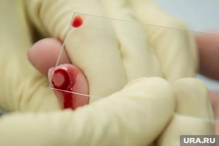 Староста уверила, что подпись-отпечаток оставлен не кровью, а помадой (архивное фото)