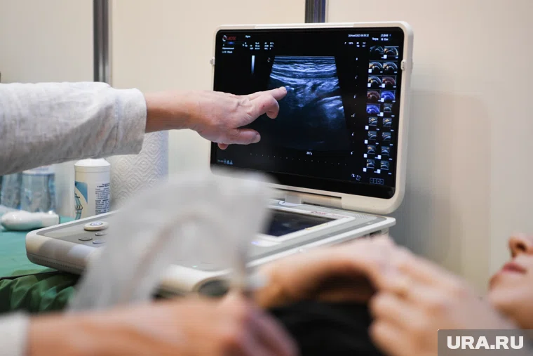 Тюменец продает камни из желчного, которые находятся внутри него