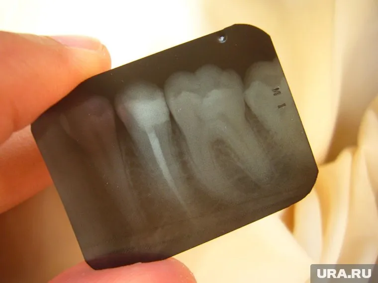 Путешественница баба Лена получила персональное приглашение из клиники на Тенерифе