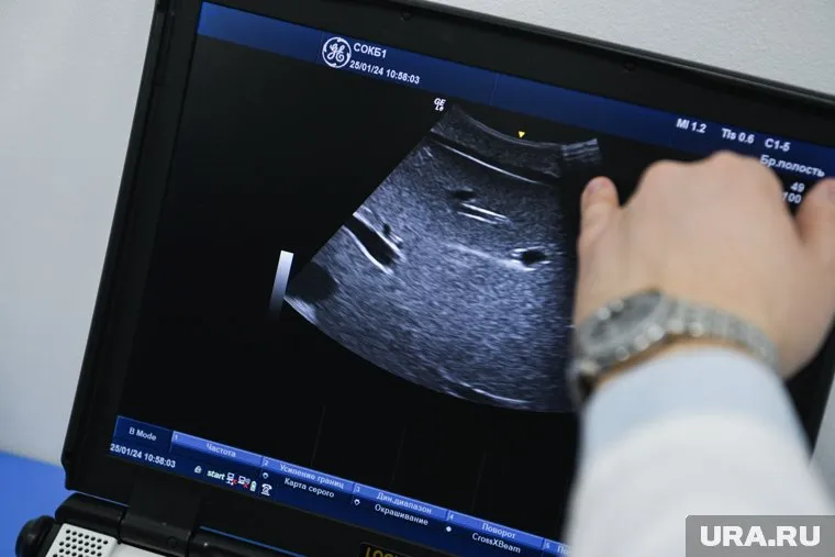 Жареная пища может быть опасна для печени