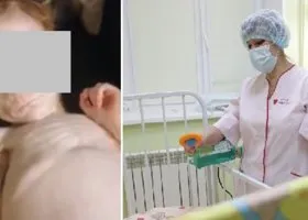 Врачи раскрыли, как живет девочка, которую держали в шкафу