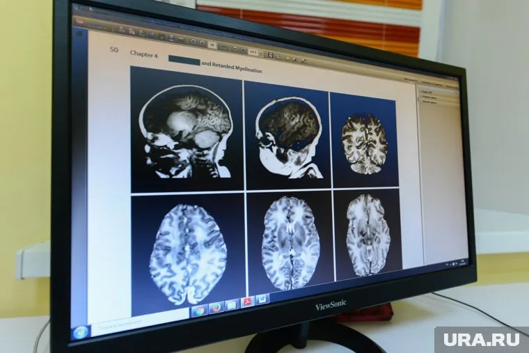 После COVID-19 у переболевших может начаться бессоница