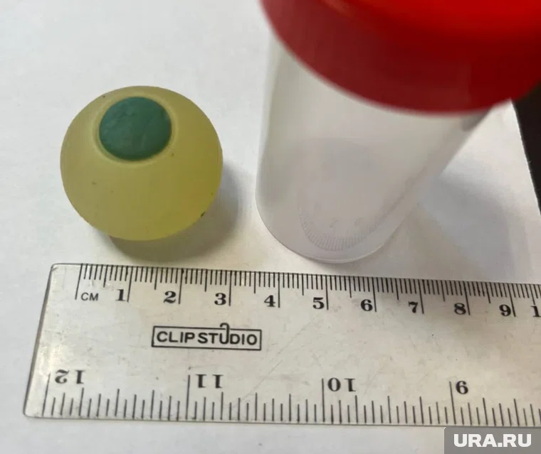 Вот такой силиконовый глаз достали из кишечника ребенка 