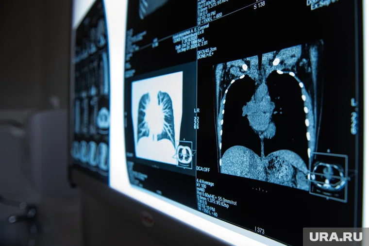 В кардиоцентр ХМАО закупили «умный» рентген