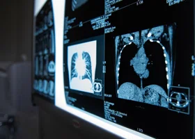 В больнице ХМАО появился рентген с искусственным интеллектом