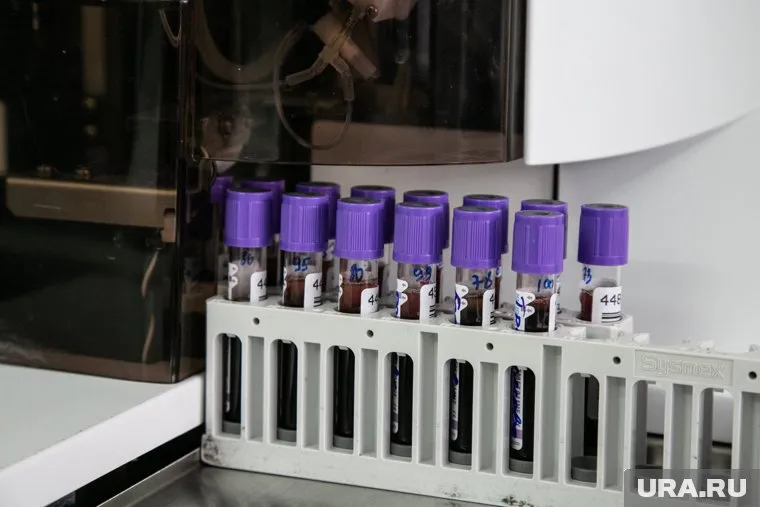 В мэрии узнали результаты анализов на коронавирус в течение суток