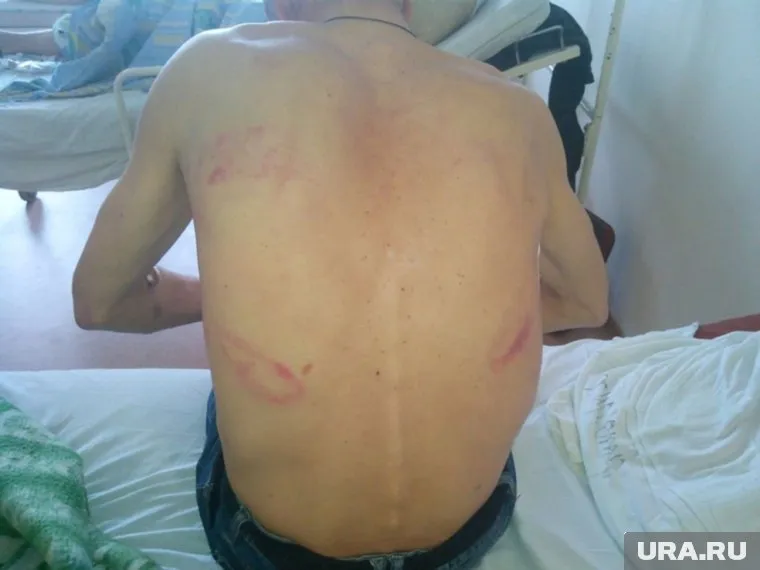 Напавшим на мужчину грозит до 10 лет колонии