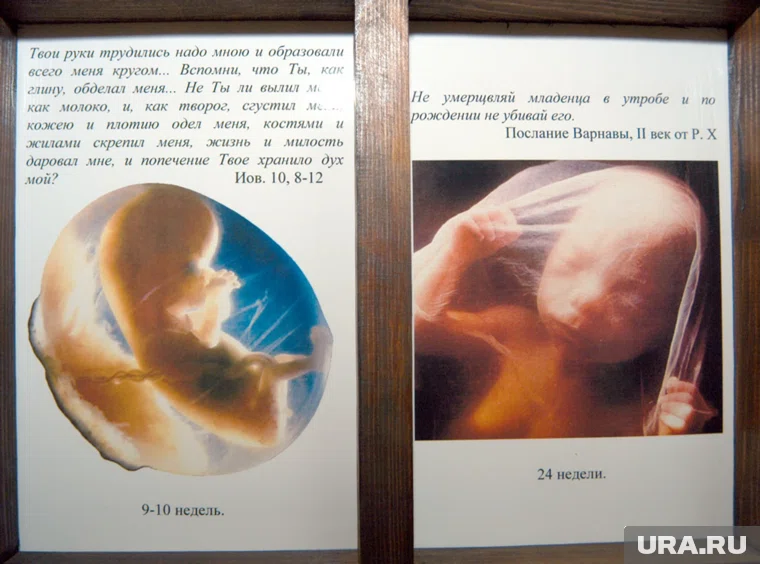 Священники РПЦ будут убеждать женщин от аборта