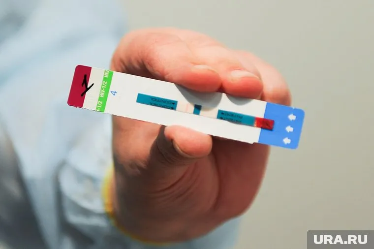 В России наблюдается положительная динамика борьбы с ВИЧ-инфекцией, заявил Алексей Мазус