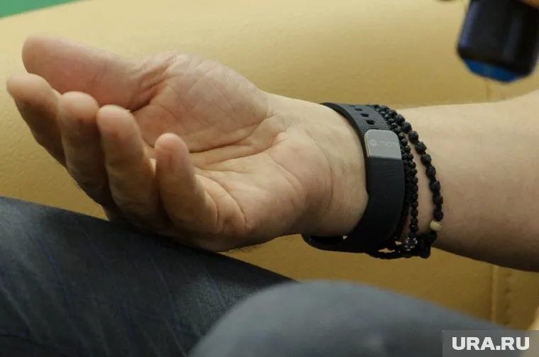 Ношение смарт-часов может вызвать контактный дерматит