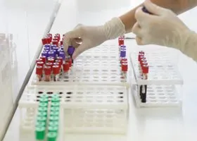 Названа дата визита ревизоров WADA в Москву