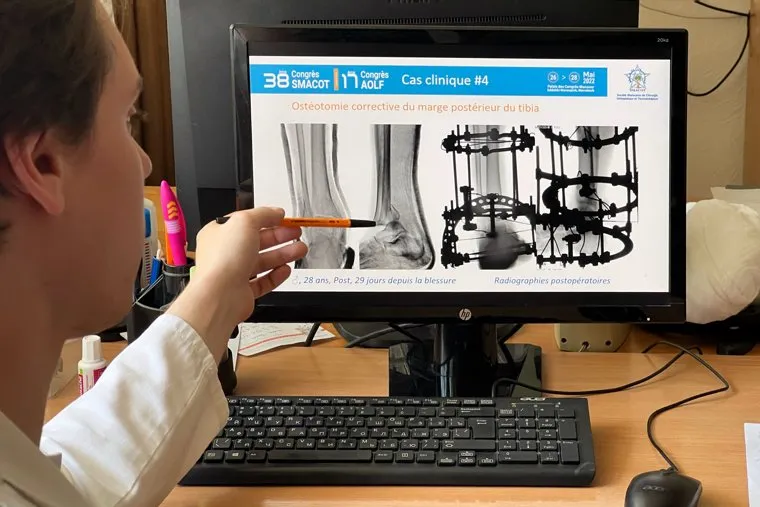 Интервью с научным сотрудником центра Илизарова Сутягиным Ильей. Курган