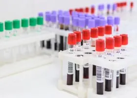 Фотография из галереи