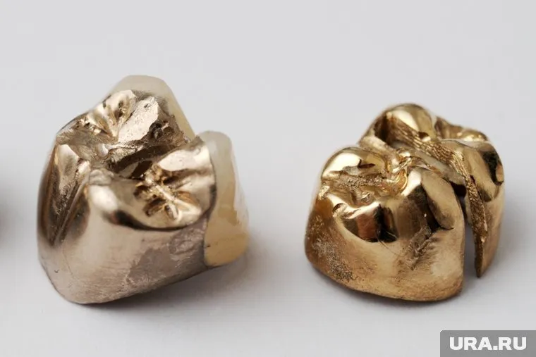 Тюменцы приносят в ломбард не только кольца и цепочки, но и зубные коронки