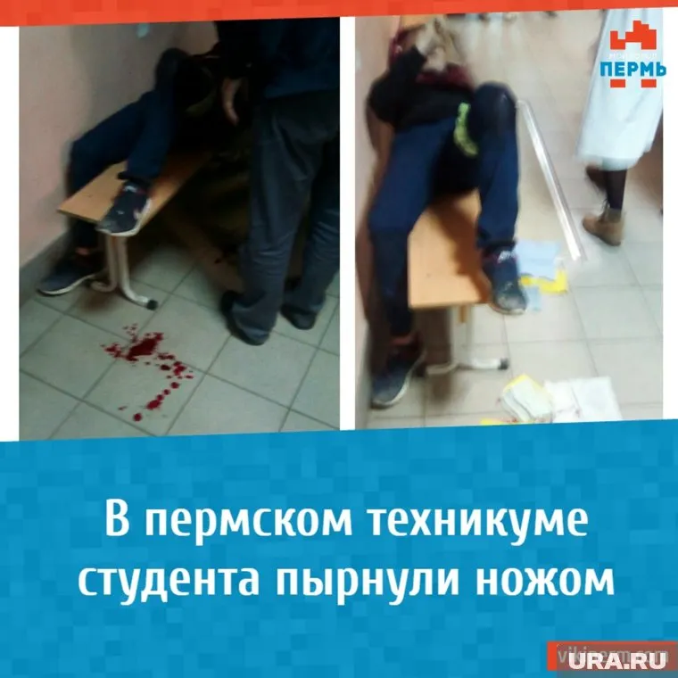 Нападавший целился юноше в живот, а попал в ногу