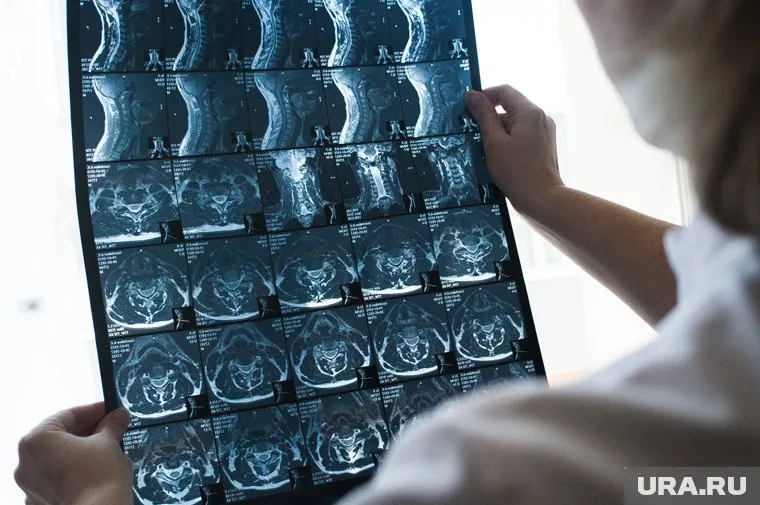 Рак эффективно поддается лечению на ранних стадиях, отметил Роман Евстратов