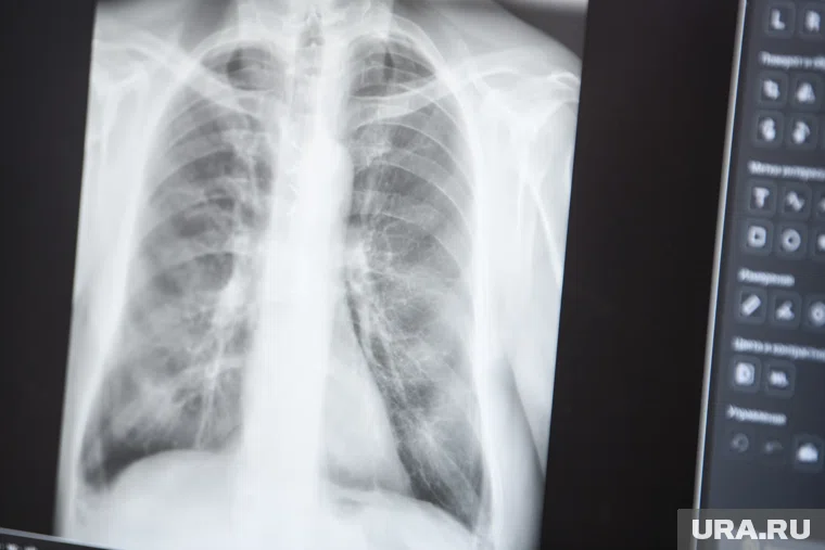 Чаще всего консультации нужны по кардиологии, эндокринологии, неврологии и педиатрии