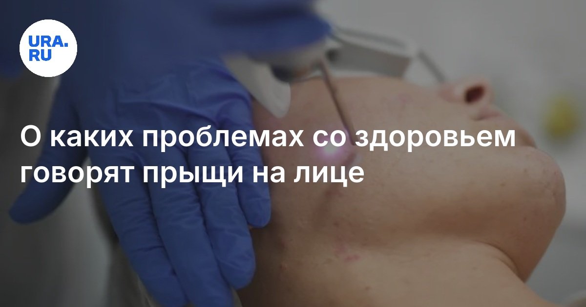 О каких проблемах со здоровьем говорят прыщи на лице