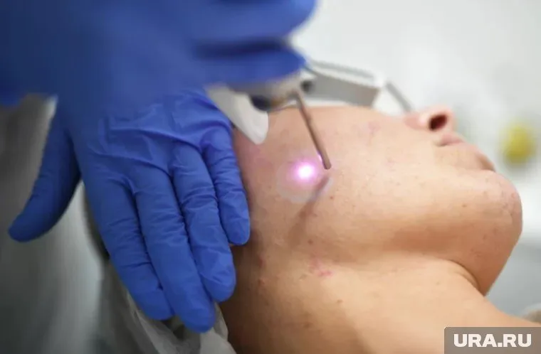 Высыпания на лице могут говорить о проблемах с ЖКТ и работой сердца