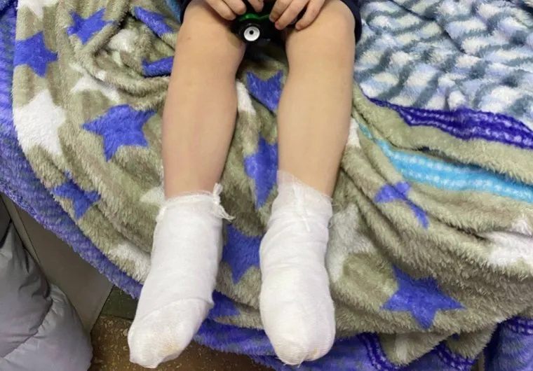 Прокурор заступился за покалеченного детсадовца 