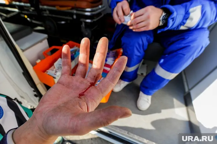 Пострадавшего увезли в больницу на скорой помощи