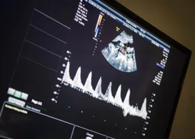 Врачи назвали возраст самой юной тюменки, сделавшей аборт