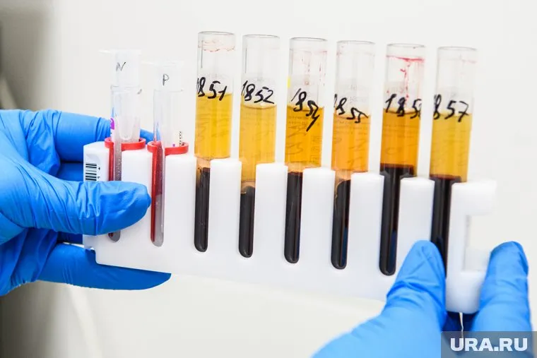 Экспертиза показала, что мобилизованный умер от передозировки наркотиками