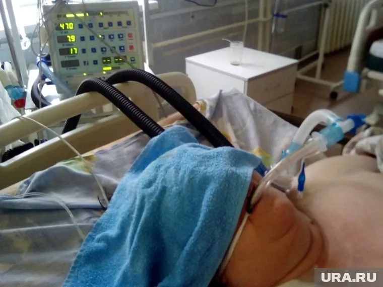 Без интубационных трубок невозможно делать операции