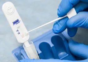 ВИЧ заражен каждый десятый екатеринбуржец, сделавший тест