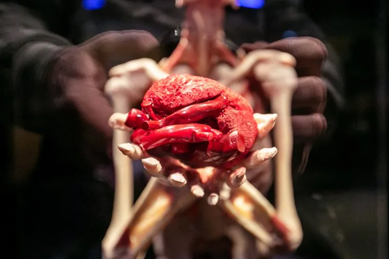 Анатомическая выставка «Мир Тела» Гюнтера фон Хагенса. Москва