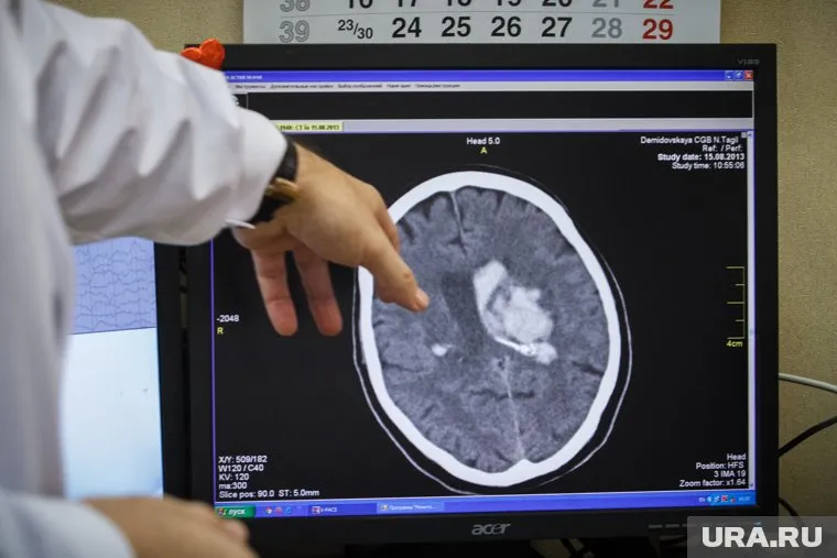 Нейрохирурги вернули женщине способность говорить и двигаться