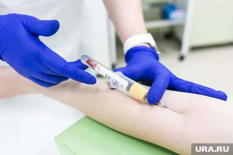 Высокий холестерин грозит атеросклерозом сосудов, сказал Андрей Кондрахин